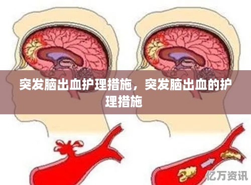 突發(fā)腦出血護理措施，突發(fā)腦出血的護理措施 