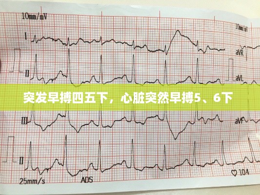 突發(fā)早搏四五下，心臟突然早搏5、6下 