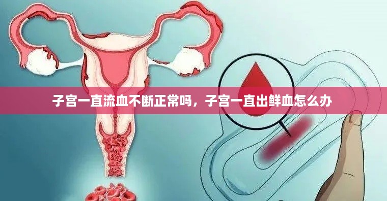 子宮一直流血不斷正常嗎，子宮一直出鮮血怎么辦 