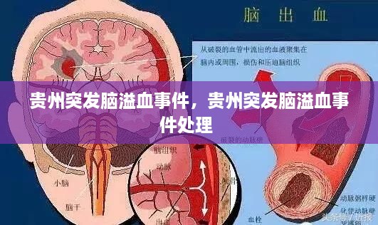 貴州突發(fā)腦溢血事件，貴州突發(fā)腦溢血事件處理 