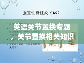 英語(yǔ)關(guān)節(jié)置換專題，關(guān)節(jié)置換相關(guān)知識(shí) 