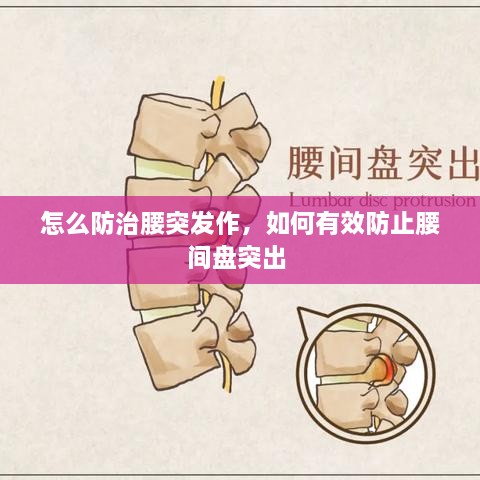 怎么防治腰突發(fā)作，如何有效防止腰間盤(pán)突出 