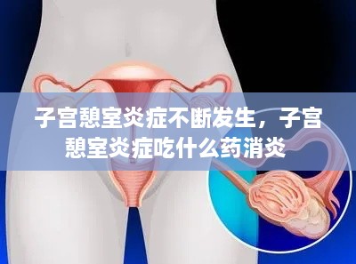 子宮憩室炎癥不斷發(fā)生，子宮憩室炎癥吃什么藥消炎 