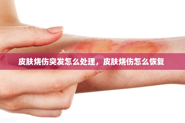 皮膚燒傷突發(fā)怎么處理，皮膚燒傷怎么恢復 